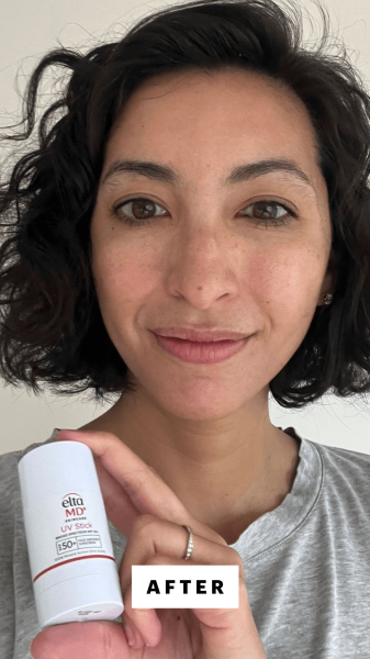 Pai after applying the EltaMD UV Stick SPF 50
